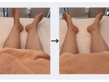 ドクターエイジレス(DR.AGELESS)/筋膜美容整体コース1回