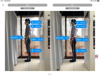 ナオル整体 大森店(NAORU整体)/30代男性、継続施術１ヶ月経過後