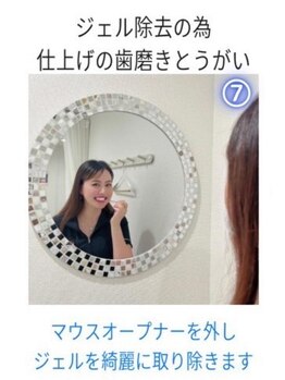 ホワイトニングショップ 成田店/【ホワイトニングの手順7】