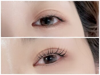 ジューシーアイ 成増店(Juicy Eye)/エグータムの驚きの効果！！！