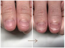 アーバンネイル/深爪矯正/自爪風