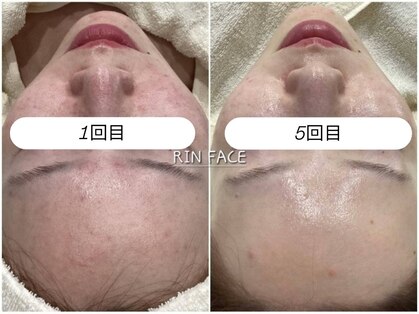 リンフェイス 銀座店(RIN FACE)の写真