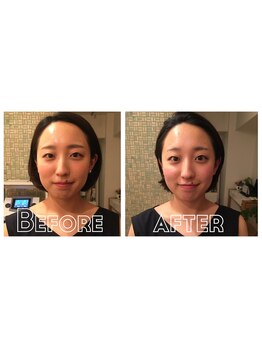 テイクオフ(Takeoff)/造顔マッサージ/小顔矯正