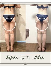 カトレア 下関店(KATOREA)/カトレアの痩身★BeforeAfter