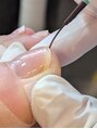 エム ネイル(M nail) HeySwitch巻爪ケアジェル