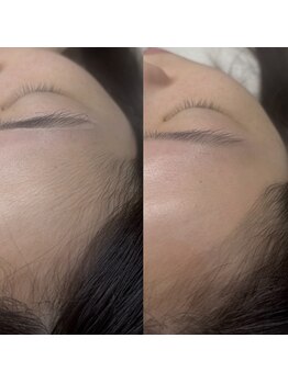 ダイヤモンドリリー キートス(Diamond Lily kiitos)/おでこWax/眉毛一宮/眉毛サロン