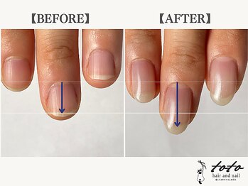 toto hair and nail【自爪育成・ネイルケア】/【toto式】自爪育成