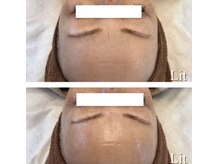 ラボーテエサンテ バイ ティアラ(la beaute et sante by Tiara)/諦めていた悩みもLitで改善