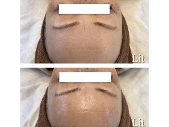 ラボーテエサンテ バイ ティアラ(la beaute et sante by Tiara)/諦めていた悩みもLitで改善