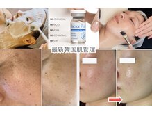 ビオラ(美ola)の雰囲気（韓国式肌育ケア!毛穴/くすみケアで艶肌♪お肌敏感な方にもお勧め）