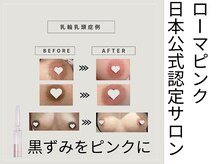 スノースキン(Snow skin)の雰囲気(ローマピンク★アフタークリーム3本+ヒアルロン酸導入プレゼント)