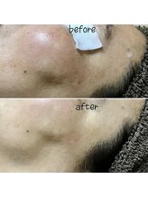 アルディート(Ardito)/ホワイトスノーピール