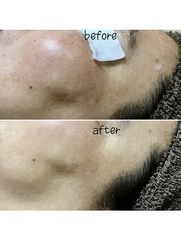 アルディート(Ardito)/ホワイトスノーピール