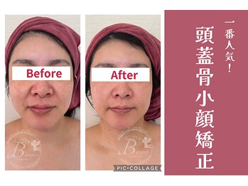 ビレナ 守谷店(Birena)/Birena式頭蓋骨小顔矯正