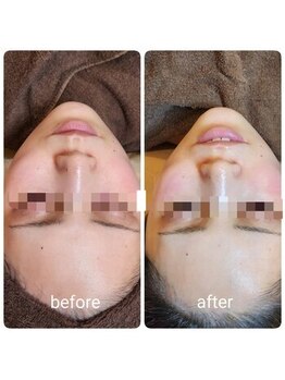 ジャドール ネイルアンドアイラッシュ(J'ADORE)/ハーブのビフォーアフター