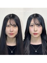 リリィミュール(LilyMule)/お客様 Before / After