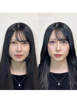 リリィミュール(LilyMule)/お客様 Before / After