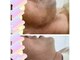 脱毛サロン ティアレ(Tiare)の写真