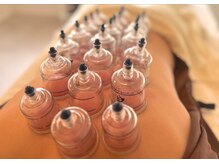 アモ(amo)/カッピング