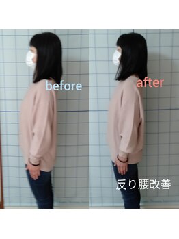 カイロプラクティック よつは/《骨盤調整前後》