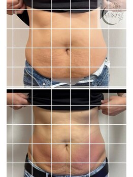 ルナ(LUNA)/BeforeAfter♪