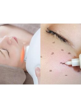 美白ケアをしたい