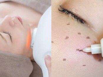 エンルーチェ(enluce)の写真/《年齢肌のお悩みに》大人のための本格シミケア&光フェイシャル★ヘッドスパ/美白パック付メニュー有◎