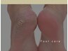 【フット】かかとすべすべ角質ケア ≪甘皮|角質ケア|パック付き≫