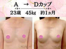 メディカルサロン エム エム エム 銀座プレミアムサロン(M.M.M.)の雰囲気（発育阻害因子を徹底改善！だから痩せ型さんでもバストアップ可能）