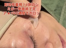 ルルアス(LuLu AS)