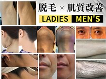 ビースキン 広島(BE:SKIN)の雰囲気（赤ら顔・赤ニキビ・黒ニキビ・敏感肌・乾燥肌・インナードライ）