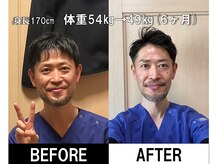 まもる整体サロン 山口店/院長自身のビフォーアフター