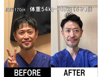まもる整体サロン 山口店/院長自身のビフォーアフター