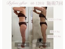 パルタージュ(Partage)/デトックス痩身エステ