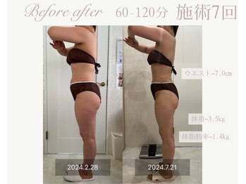 パルタージュ(Partage)/デトックス痩身エステ