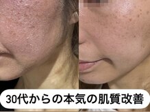リノアンド(Lino&)