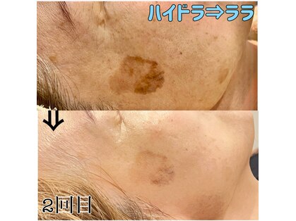 ルシア(LUCIA)の写真