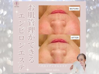 ノノサロン(nono salon)/モニター様