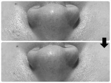 エフェクト 塚口店(effect)/Before After &nbsp;&nbsp;40代/1回目