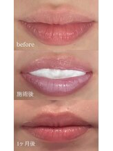 ロゼ(Rosse)/ローマピンク