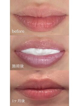 ロゼ(Rosse)/ローマピンク