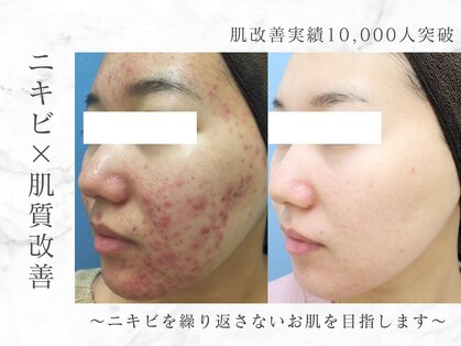 エピア 西尾店(Epia)の写真