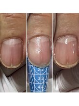 ルーチェ バイ フェリシア(LUCE by Felicia)/爪の縦割れ補強