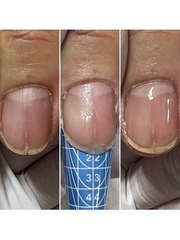 ルーチェ バイ フェリシア(LUCE by Felicia)/爪の縦割れ補強