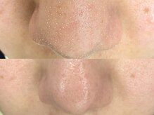 ライリー(Rairy)の雰囲気（【毛穴/角質/黒ずみ】オーダーメイドスッキリ毛穴洗浄）