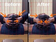 アンフィニ(Infini)/削らない！！小顔は頭蓋骨★