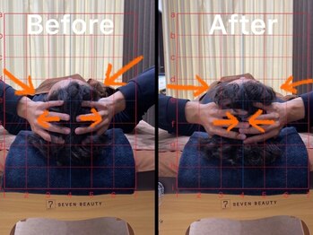 アンフィニ(Infini)/削らない!!小顔は頭蓋骨★