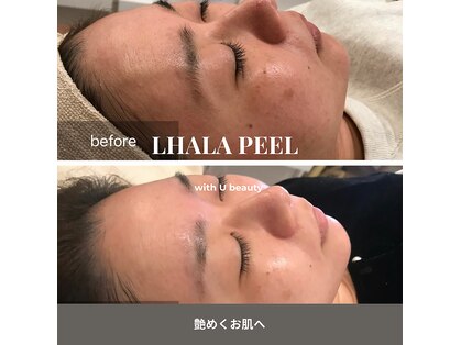 ウィズ ユー ビューティ(with U beauty)の写真