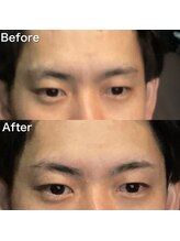 眉毛ハウス 吉祥寺店(眉毛HOUSE)/お客様の施術例(吉祥寺/東京)