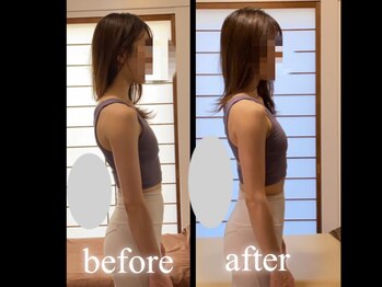 サンクエール 代官山鍼灸院(CINQ AILES)/矯正　反り腰・ストレートネック